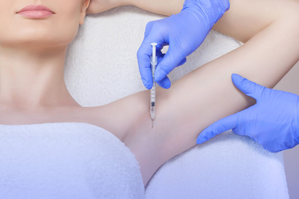 Underarm Botox, a Proven Method to Reduce Sweating